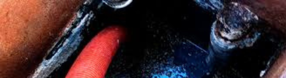 Sucção da Caixa de Gordura  24 HORAS